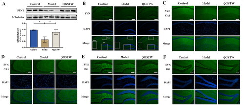 Figure 8. Effects of QGSTW on the protein expression level of SYN in d-galactose-injured mice. (A) Representative Western blot and quantitative analysis of the protein expression level of SYN in the mouse hippocampus. (B–F) Representative immunofluorescence images of SYN (green, FITC) in different subregions of the hippocampus (scale bars: B = 100 μm; C–F = 50 μm). The nuclei were stained blue (DAPI). CA1: cornu ammonis 1; CA3: cornu ammonis 3; DG: dentate gyrus. Compared with the control group: *p < 0.05 and **p < 0.01. Compared with the model group: #p < 0.05 and ##p < 0.01. One-way ANOVA was used for all data analyses. The data are presented as the mean ± SEM (n = 3 mice per group).