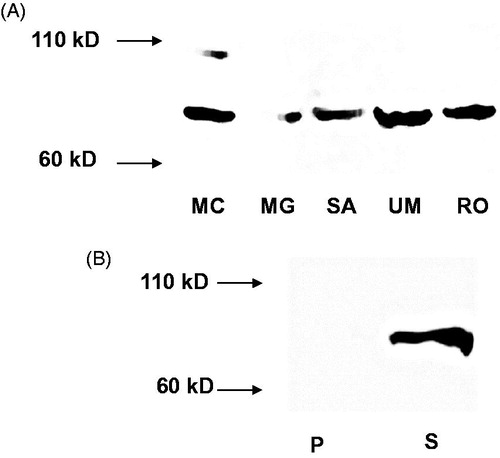 Figure 2. (A) Western blot of iPLA2ß in osteoblastic cells. Cells were lysed and aliquots of protein lysates were subjected to SDS-PAGE and transferred to nitrocellulose. MC = MC3T3-E1; MG = MG63; SA = SAOS-2; UM = UMR-106; RO = ROS 17/2.8. (B) Western blot of iPLA2ß in murine MC3T3-E1 cells after subcellular fractionation (100 000×g). P = pellet, containing membrane fractions; S = supernatant (100 000×g) corresponding to cytosolic fraction.