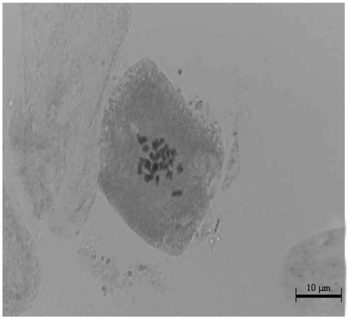 Figure 11. Metaphase chromosomes of Klasea kurdica (scale bar 10 μm).