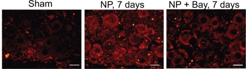 Figure 5 Suppression of CGRP expression in DRG neurons of NP-treated rats by Bay11-7082 (Bay).