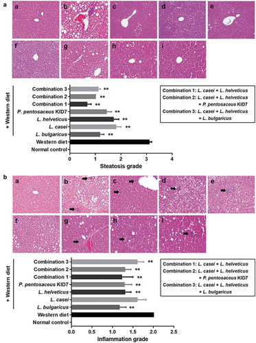 Figure 3. Pathological effects of probiotics on the liver (Hematoxylin and Eosin stain). (a) Steatosis grade. normal control (a), Western diet (b), L. bulgaricus (c), L. casei (d), L. helveticus (e), P. pentosaceus KID7 (f), combination 1 (g), combination 2 (h), and combination 3 (i). (B) Inflammation grade. Mild to moderate inflammation, favoring lymphocytes, is identified in the perivenular area (b, arrow).