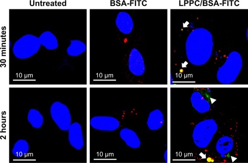 Figure 5 Localization of LPPC/BSA-FITC complexes in HepG2 cells.Notes: HepG2 cells were untreated (left panels) or treated with BSA-FITC (central panels) or LPPC/BSA-FITC complexes (right panels). The lysosomes and nuclei of the cells were individually stained red and blue, respectively. The cells were observed and imaged by confocal microscopy. Localization of BSA-FITC and lysosomes is indicated by white arrows. The escape of BSA-FITC from the lysosome (at 2 hours postincubation) is indicated by a white arrowhead. Representative images of three independent experiments are shown.Abbreviations: FITC, fluorescein isothiocyanate; LPPC, liposomes containing polyethylenimine and polyethylene glycol complex.