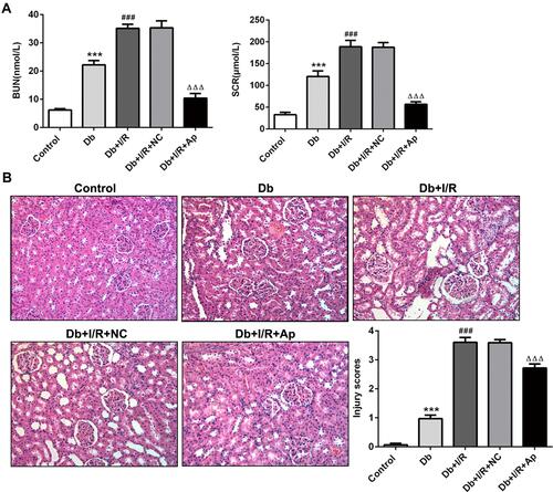 Figure 1 Effects of Apelin on the function and histological structure of kidneys. (A) Relative biochemical kits for detection of BUN and SCR levels in the serum of rats in five groups. (B) H&E staining of histopathological changes in five groups of kidney tissues. ***P<0.001 vs Control; ###p<0.001 vs Db; ΔΔΔp<0.001 vs Db+I/R+NC.