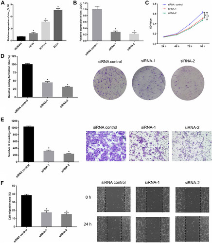 Figure 2 Silencing circ_GLG1 inhibits the proliferation, migration, and invasion of CRC cells. (A) Circ_GLG1 is significantly higher in CRC cell lines than in normal colonic epithelial cells. (B) Both siRNA-1 and siRNA-2 silence circ_GLG1 expression in DLD1 cells. Downregulating circ_GLG1 expression suppresses DLD1 cell (C) proliferation, (D) colony-formation, (E) invasion, and (F) migration. *P < 0.05.