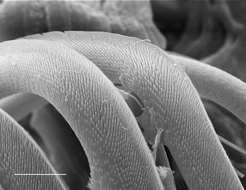 Figure 5. Notochaetae: Eupolymnia nebulosa (64°01′ N, 13°30′ W, 190 m, scale 10 μm).