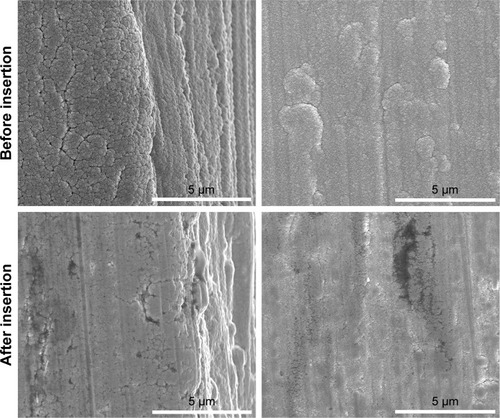 Figure 4 Images of the Ti-Sr-O surface, acquired at the cutting edge of the implant, before (top) and after (bottom) insertion into the block of POM. Scale bar is 5 µm.Abbreviations: Ti-Sr-O, strontium-functionalized surface; POM, polyoxymethylene.