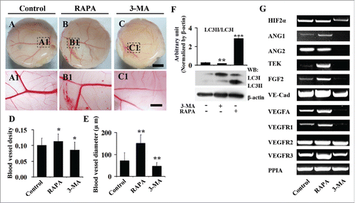 Figure 4. The 3-MA exposure reduces and RAPA exposure promotes angiogenesis in chick CAM. (A-B) The representive images of vessel plexuses in CAM, which were treated with DMSO (control, A), RAPA (B) and 3-MA (C) for 2 d. (D-E) The bar chart showing the comparison of blood vessel densities and diameters among control, RAPA-treated and 3-MA-treated groups. (F) Western blot data showing the expressions of LC3-I and LC3-II following the treatments of RAPA and 3-MA. (G) The RT-PCR data showing the expressions of HIF 2α, ANG1, ANG2, VEGFA, TEK, VE-Cadherin, FGF2, VEGFR1, VEGFR2 and VEGFR3 in control, RAPA-treated and 3-MA-treated CAM tissues. Scale bars = 1 cm in A-C and 3 mm in A1-C1.