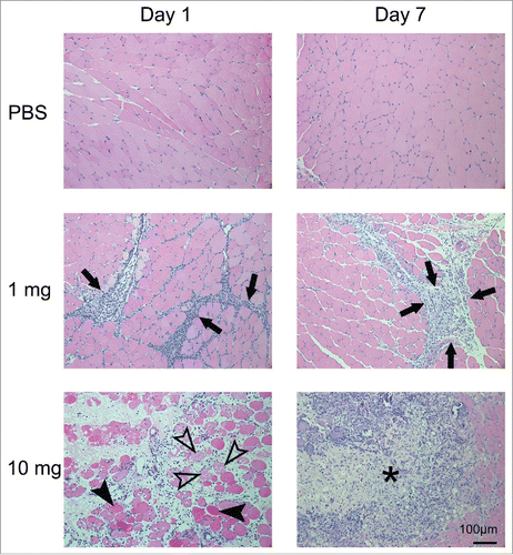 Figure 4. Histopathology of the left tibialis anterior muscle after injection of SLA/LA. C57BL/6 mice (n = 6/group) were injected i.m. with 0, 1 or 10 mg SLA/LA. Left T.A. muscles were collected and fixed 1 or 7 days following injection. H&E stained slides were prepared for each muscle and evaluated by a pathologist. A representative image of a single mouse per group imaged at the time points indicated is shown. Arrows: infiltration of inflammatory cells; open arrowheads: necrotic muscle cells; closed arrowheads: degenerated muscle cells; *: foci of acute to subacute inflammation.