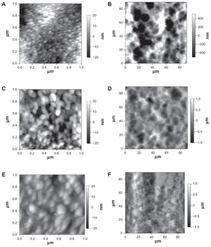 Figure 3 Atomic force microscopy micrographs showing the topography of A) and B) 20 nm, C) and D) 80 nm, and E) and F) conventional titanium. The images in A, C), and E) show higher magnification scans, highlighting the nanotopography of the samples, and the images in B, D), and F) show lower magnification scans, highlighting the micron-topography of the samples.
