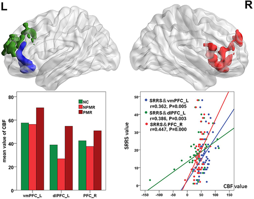 Figure 1 Main effect of PMR on the CBF of the whole brain. The histograms exhibit the numerical representation of the CBF of the clusters in the PFC. The CBF of bilateral PFC in PMR group was significant increased, compared with NCs and NPMR group. The scatter diagram shows the significant correlation in the PFC between the CBF and PMR severity as described using the SRRS scores.