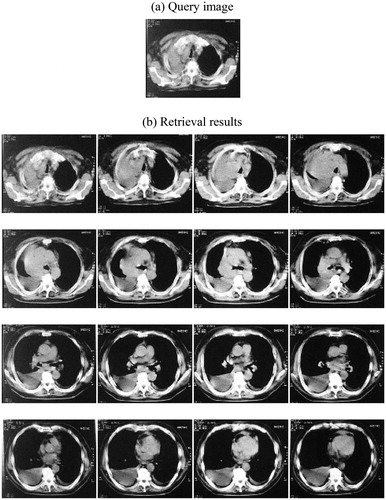 Figure 6. Experimental results for chest CT image.