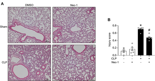 Figure 4 Necroptosis attenuates lung injury in CLP-induced sepsis. Sepsis was induced via CLP in mice. Sham operated mice functioned as a control. C57BL/6 mice were injected i.p. with either necrostatin-1 (1 mg/kg) or vehicle in equivalent volumes immediately following CLP. 20 h post sham or CLP operation, lungs were collected. (A) The lungs were sliced into 5 μm sections and then stained with hematoxylin and eosin. Samples were examined using light microscopy. (B) Samples were given an injury score scored using a scoring system for acute lung injury in experimental animals as outlined by the American Thoracic Society. n=6 mice/group (each circle represents the tissue sample obtained from one mouse). *p<0.05 vs (-) CLP, (-) Nec-1; #p<0.05 vs (+) CLP, (-) Nec-1. Data are expressed as means ± SEM. Groups were compared by one-way ANOVA and Tukey’s multiple comparisons test.