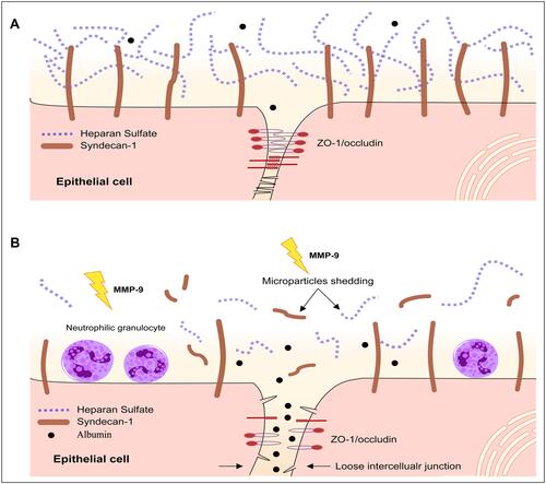 Figure 10 Structure of epithelial glycocalyx and tight junction. Epithelium was covered with a layer of glycocalyx, whose main component is SDC-1 (A). Tight junction proteins consist of the integral transmembrane protein occludin and intracellular protein ZO-1 and other accessory proteins (A). The ZO-1 binds to the cytoplasm of occludin. When the structures of the glycocalyx and tight junction proteins were damaged, albumin leakage occurred (B).