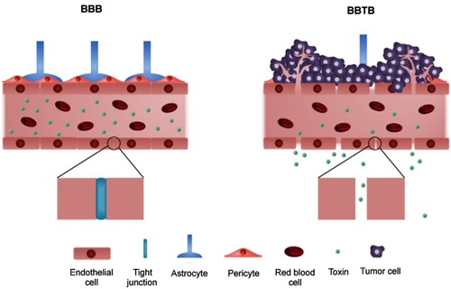 Figure 1 The structure of blood–brain barrier (BBB) and blood–brain tumor barrier (BBTB). The blood vessels with the intact BBB are enclosed by endothelial cells with tight junction while the tight junction between endothelial cells is disrupted by infiltration of tumor cells in the BBTB.