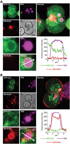 Figure 9. LC3-coated endocytic vacuoles are not coated by F-actin; F-actin-coated endocytic vacuoles are not coated by LC3. GFP-LC3 PACs were stained with SiR-Actin (to reveal F-actin distribution) and incubated for 30 min in the presence of 100 pM CCK and TRD. In these experiments we imaged 196 cells isolated from 8 mice. We analyzed 583 EVs, of which 47 were LC3-coated and 51 were actin-coated. There were no EVs labeled with SiR-Actin and GFP-LC3 simultaneously. (A) This part shows GFP-LC3 – positive EV, which was not stained with SiR-Actin. The image combines fluorescence of GFP-LC3 (green), TRD (magenta) and SiR-Actin (red). Scale bar is shown on the transmitted light (TL) image and corresponds to 10 µm. Selected EV with neighboring region of cytoplasm is highlighted by dashed square on the large right panel and shown on expanded scale in the lower panels. The fluorescence intensity profile along the arrow is plotted in the bottom right panel. EV is coated by LC3 but not by F-actin. (B) This part shows SiR-Actin -positive EV, which was not coated with GFP-LC3. The image combines fluorescence of GFP-LC3 (green), TRD (magenta) and SiR-Actin (red). Scale bar is shown on the transmitted light (TL) image and corresponds to 10 µm. Selected EV with neighboring region of cytoplasm is highlighted by dashed square on the large right panel and shown on expanded scale in the lower panels. The fluorescence intensity profile along the arrow is plotted in the bottom right panel. EV is coated by F-actin but not by LC3.