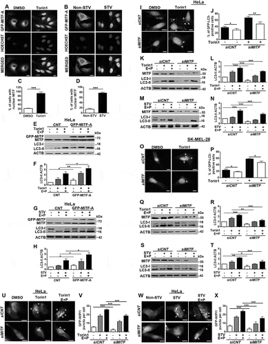 Figure 1. MITF was required for starvation and MTOR inhibition-induced autophagy. (a and b) MITF translocated to nuclei of cells following torin1 (MTOR inhibitor) (a) or starvation (b) treatment. HeLa cells were transiently transfected with GFP-MITF-A vector and incubated with either torin1 (200 nM, 4 h) or in starvation medium (Earle’s Balanced Salt solution, 4 h, STV) and analyzed under a flourescence microscope. DMSO, carrier control. Non-STV, non-starved. Hoechst dye was used to stain the nuclei (blue). Scale bar: 10 µm. (c and d) Quantitative analysis of MITF nuclear translocation in the experimental set-up shown in A and B (mean± SD of n = 3 independent experiments, ***p < 0.01). (e) Overexpression of MITF-A amplified torin1-induced LC3-II (lipid-conjugated and autophagosome-associated LC3 form) formation in HeLa cells. LC3-I, free LC3 form. E + P, E64D (10 µg/ml) and pepstatin A (10 µg/ml) were used as lysosomal protease inhibitors. (f) Graph depicting quantification of LC3-II:ACTB ratios in the experimental set-up shown in E (mean± SD, n = 3 independent experiments, **p < 0.03, *p < 0.05). (g) Overexpression of MITF-A increased starvation-induced LC3-II formation in HeLa cells. (h) Graph depicting quantification of LC3-II:ACTB ratios in the experimental set-up shown in G (mean± SD, n = 3 independent experiments, *p < 0.05). (i) MITF knockdown by siMITF attenuated torin1-induced GFP-LC3 puncta formation compared to control siRNA (siCNT)-transfected HeLa cells. Scale bar: 10 µm. (j) Quantitative analysis of GFP-LC3 dots in the experimental set-up shown in I (mean± SD of n = 3 independent experiments, **p < 0.03, *p < 0.05). (k) Immunoblots of siCNT- or siMITF-transfected HeLa cells that were treated with DMSO or torin1. (l) Graph depicting quantification of LC3-II:ACTB ratios in the experimental set-up shown in K (mean± SD, n = 3 independent experiments, ***p < 0.01). (m) Immunoblots of siCNT or siMITF transfected and non-starved or starved HeLa cells. (n) Graph depicting quantification of LC3-II:ACTB ratios in the experimental set-up shown in M (mean± SD, n = 3 independent experiments, ***p < 0.01). (o) siMITF blocked torin1-induced GFP-LC3 puncta formation in SK-MEL-28 cells. Scale bar: 10 µm. (p) Quantitative analysis of GFP-LC3 dots in the experimental set-up shown in O (mean± SD of n = 3 independent experiments,*p < 0.05). (q) Immunoblots of siCNT- or siMITF-transfected SK-MEL-28 cells that were treated with DMSO or torin1. (r) Graph depicting quantification of LC3-II:ACTB ratios in the experimental set-up shown in Q (mean± SD, n = 3 independent experiments, ***p < 0.01, **p < 0.03). (s) Immunoblots of siCNT- or siMITF-transfected and non-starved or starved SK-MEL-28 cells. (t) Graph depicting quantification of LC3-II:ACTB ratios in the experimental set-up shown in S (mean± SD, n = 3 independent experiments, ***p < 0.01, **p < 0.03, *p < 0.05). (u) siMITF blocked torin1-induced GFP-WIPI1 puncta formation in HeLa cells. Scale bar: 10 µm. (v) Quantitative analysis of GFP-WIPI1 puncta in the experimental set-up shown in U (mean± SD of n = 3 independent experiments, ***p < 0.01). (w) siMITF blocked starvation-induced GFP-WIPI1 puncta formation in HeLa cells. Scale bar: 10 µm. (x) Quantitative analysis of GFP-WIPI1 dots in the experimental set-up shown in W (mean± SD of n = 3 independent experiments, ***p < 0.01).