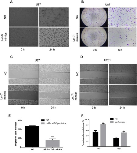Figure 7 Overexpression of miR-let-7i-5p reduces the migration of glioma cells. (A) A VM formation assay of U87 cells was performed for 24 h. (B, E) U87 cells were transfected with the NC or miR-let-7i-5p mimics. Cell migration was assessed 6 h after culture by transwell analysis. (C, D, F) U87 and U251 cells were transfected with the NC or miR-let-7i-5p mimics, and wound healing assays were performed during the 24-h recovery period. *P < 0.05; ***P < 0.001.