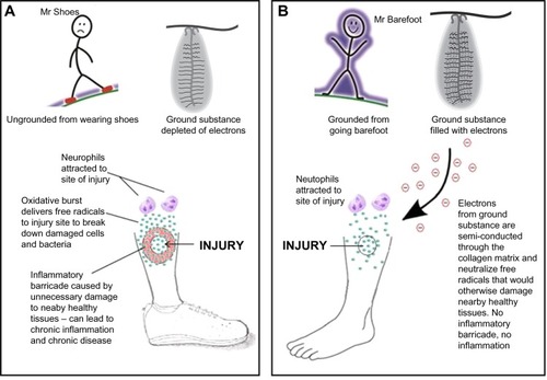 Figure 16 Summary of central hypothesis of this report: comparison of immune response in ungrounded versus grounded person.Notes: (A) After an injury, the ungrounded person (Mr Shoes) will form an inflammatory barricade around the injury site. (B) After an injury, the grounded person (Mr Barefoot) will not form an inflammatory barricade, because reactive oxygen species that could damage nearby healthy tissue (collateral damage) are immediately neutralized by electrons semiconducted from the electron-saturated ground substance via the collagen network.