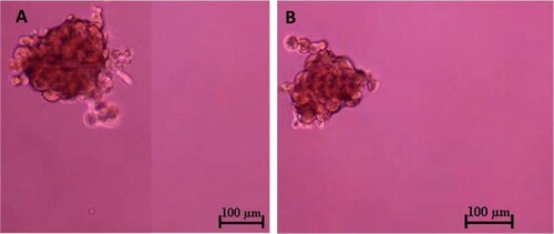 Figure 6. Tumour sphere formation assay of CMT-Stylo (A) and CMT-Star (B) cells. The tumour spheres here were pictured after 7 days of incubation of respective cell lines in stem cell enrichment media, in ultralow attachment plates. The average size of the spheres formed by CMT-Stylo cells is 226 ± 51.2 µm in diameter, while that of CMT-Star cells is 224.5 ± 47.5 µm in diameter. Bar = 100 µm.