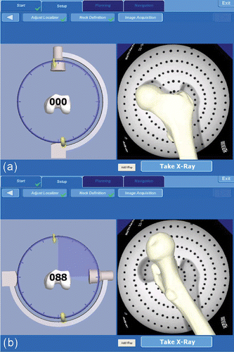 Figure 2. Image acquisition with the zero-dose C-Arm navigation. (a) Preview of frontal view (acquired image in the background). (b) Preview of lateral view prior to second image acquisition. [Color version available online.]