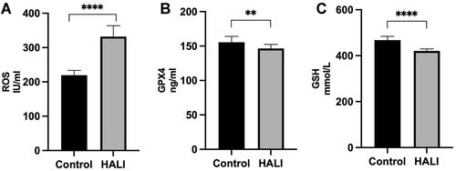 Figure 3 ELISA detection of ROS (A), GPX4 (B) and GSH (C) expressions in rats. ****P < 0.0001, **P < 0.01 and ****P < 0.0001 vs the control group. The values represent the mean ± SD, n = 10.