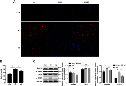 Figure 6 The KOR agonist suppressed the Ca2+/CaMKII/CREB pathway in NP rats. (A) Cellular calcium level in dorsal root ganglia detected by IF (scale bar = 20µm); (B) Glutamate level in rats’ dorsal root ganglia detected by ELISA; (C) The protein expression level of CaMKII, CREB and related phosphorylated protein detected by Western blotting; *p < 0.05.