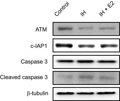 Figure 5 Verification of protein expression levels of ATM and c-IAP1 in IH-exposed HUVECs treated with or without estradiol (E2). E2 increased the levels of ATM and c-IAP1, and decreased the level of cleaved caspase 3 in IH-exposed HUVECs. Protein expression levels of ATM, c-IAP1 and downstream target, caspase 3, in IH-exposed HUVECs treated with or without E2 were verified by Western blotting. β-tubulin was used as an internal control.