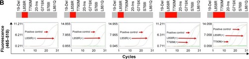 Figure 6 The relationship between acquired resistance induced by continuous gefitinib treatment and EGFR mutation.Notes: (A) Course of the disease with CT images and treatment history and driver mutation. (B) L858R and T790M mutation detection via ARMS-PCR.Abbreviations: ARMS-PCR, amplification refractory mutation system polymerase chain reaction; CT, computed tomography; CTC, circulating tumor cell; EGFR, epidermal growth factor receptor.