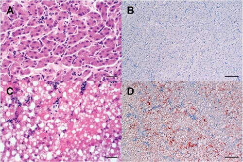 Figure 5. Light microscopic finding in the livers of experimentally H5N8B-infected ducks. (A, B) Seropositive mallard, H5N8B-infected, clinically normal, 34 dpi, liver. (A) No obvious findings. (B) Lack of immunohistochemically-detectable hepatocellular influenza A virus matrixprotein antigen. (C, D) Pekin duck, contact animal, died 4 days post contact, liver. (C) Marked hypereosinophilia, hepatocellular vacuolation, membraneous rupture and nuclear pyknosis, karyorrhexis and lysis interpreted as severe, acute, coalescing to diffuse necrotizing hepatitis. (D) Immunohistochemistry reveals coalescing intrahepatocytic, intracytoplasmic and intranuclear influenza A virus matrix protein. (A, C) Hematoxylin-eosin, (B, D) Immunohistochemistry using the avidin-biotin-peroxidase-complex method with a monoclonal antibody against influenza A virus matrix protein (ATCC clone HB-64), 3-amino-9-ethylcarbazol chromogen (redbrown) and hematoxylin counterstain (blue). (A, C) bars = 20 μm. (B, D) bars = 50 μm.