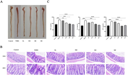 Figure 1. Effects of SNS on colon histopathological changes in WIRS mice. (A) Photographs of colonic tissue from 6 groups of mice. (B) Histopathological examination of 6 groups of mice colonic tissue. (C) Effects of SNS on the levels of TNF-α, IFN-γ and IL-6 in colon tissue of mice in 6 groups (n = 6-8). (####p < 0.0001 vs. the control group; **p < 0.01, ***p < 0.001, ****p < 0.0001 vs. the WIRS group). Control: control group, WIRS: water immersion restraint stress group, SL: SNS low-dose group, SM: SNS middle-dose group, SH: SNS high-dose group, DZ: diazepam group.