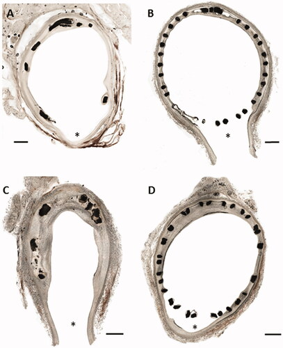 Figure 4. Histopathological cross-sections of pig arteries four weeks after implantation of a drug eluting coated zinc alloy of a thicker strut design (176 µm) D3 (A) and a standard Nitinol control stent (B) in the femoral artery bifurcation at the orifice of the sidebranch (indicated by *). C shows a cross section 12 weeks after implantation of a bare zinc alloy stent in comparison to a Nitinol stent after the same time (D). The scale bar represents 1 mm. The struts of the control stent cover the orifice of the sidebranch indicating a so called ‘stent jail’.