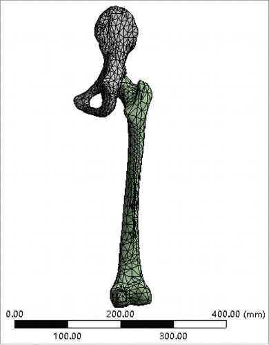 Figure 4. Finite element model of the hip joint.