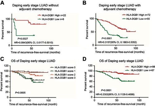 Figure S2 (A) Kaplan-Meier plots depicting RFS of early-stage LUAD patients without adjuvant chemotherapy stratified by HLA-DQB1 level (P=0.0027). (B) Kaplan-Meier plots depicting RFS of early-stage LUAD patients with adjuvant chemotherapy stratified by HLA-DQB1 level (P<0.0001). (C) Kaplan-Meier plots depicting the OS of early-stage LUAD patients stratified by tumor HLA-DQB1 staining scores (P=0.0005). (D) Kaplan-Meier plots depicting the OS of early-stage LUAD patients stratified by tumor HLA-DQB1 level (P<0.0001). Abbreviations: LUAD, lung adenocarcinoma; RFS, recurrence-free survival.