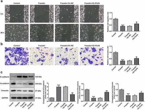 Figure 6. PLK4 overexpression reverses the effect of Fraxetin on migration and invasion of DU145 prostate cancer cells. Control DU145 cells or cells that transfected with indicated vectors were exposed to 40 μM Fraxetin or not, then (a) cell migration was observed by wound-healing assay (magnification, x100); (b) cell invasion was measured by transwell assay (magnification, x100); (c) the protein expression was detected by western blot assay. ***P < 0.001 vs Control; #P < 0.05, ##P < 0.01 and ###P < 0.001 vs Fraxetin+Ov-NC.