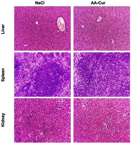 Figure 6 Histological analysis of the liver, kidney and spleen isolated from animals after repeated administration of AA-Cur.Notes: Animals were injected iv with 0.9% NaCl or AA-Cur (70 mg/kg bm). Administrations were repeated once a week for 4 weeks. Animals were euthanized on 30th day of the experiment. Representative pictures of tissue sections from three mice are presented.Abbreviation: AA-Cur, alginate-curcumin conjugate.