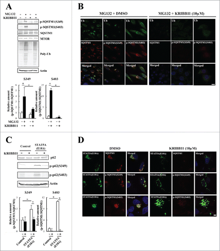 Figure 5. Phosphorylation of S349 and S403 on SQSTM1 is suppressed by a KRIBB11 HSF1 inhibitor. (A) HeLa cells were treated with 10 µM MG132 and 50 µM KRIBB11 for 12 h. Cell lysates were subjected to immunoblot analysis. Band intensities were measured, and phosphorylated SQSTM1 values were normalized to total SQSTM1. The data are reported as means ± SD (n = 4). Statistical analyses were performed using one-way ANOVA, followed by the Tukey post-hoc test. *P < 0.01. (B) Colocalization of SQSTM1 with ubiquitinated inclusions were immunocytochemically assessed in cells treated with MG132 alone (left) or MG132 and KRIBB11 (right). Cell nuclei were counterstained blue with DAPI. Scale bar: 10 μm. (C) HeLa cells were transiently transfected with mock control or pEGFP-STAT5A(E18Δ) (STAT5A[E18Δ]), and then treated (+) with or without (−) 50 µM KRIBB11. After 12 h, cell lysates were examined by immunoblot analysis. Band intensities of S349- and S403-phosphorylated SQSTM1 were measured, and the data are reported as means ± SD (n = 4). Statistical analyses were performed using one-way ANOVA, followed by the Tukey post-hoc test. *P < 0.01, **P < 0.05. (D) Colocalization of SQSTM1 with EGFP-STAT5A(E18Δ) were immunocytochemically assessed in cells treated with DMSO control (left) or KRIBB11 (right). Cell nuclei were counterstained blue with DAPI. Scale bar: 10 μm.