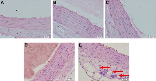 Figure 4 Hematoxylin and eosin staining in aortic tissue of the rat models in various treatment groups.
