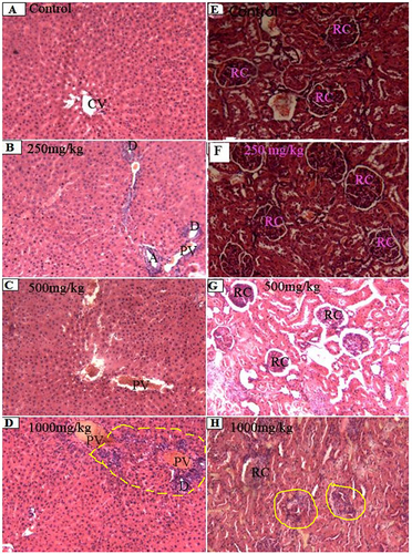 Figure 2 Photomicrographs of liver (A–D) and kidney (E–H) sections (magnification: X100, H&E). (A–C) Normal structure of liver hepatocytes arranged radiating from the central vein (CV) with portal vein (PV), branch of bile duct (D), and branch of hepatic artery (A). (D) Normal liver structure except the few periportal lymphocytic infiltrations (Yellow marked area). (E–G) Normal kidney cortex with renal corpuscles (RC). (H) Normal kidney cortex except the little distortion of the glomerulus (Yellow circles).