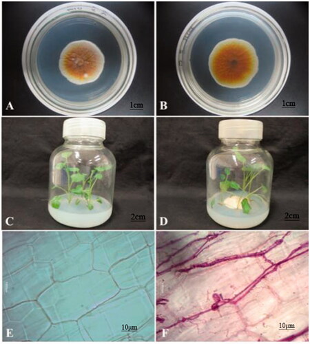 Figure 1. Endophytic fungus and host plant materials. (A) Positive side of U104 strain; (B) Back of U104 strain; (C) Tissue culture seedling control group; (D) Tissue culture seedling U104 group; (E) Plant tissue cell control group; (F) Plant tissue cell U104 group. A and B are test strain U104. C is just Salvia miltiorrhiza sterile plantlet, which is used as the control group. D is endophytic fungus and Salvia miltiorrhiza interaction group. E and F are the results of fungus U104 infection the roots of Salvia miltiorrhiza sterile plantlet tablet dyeing.