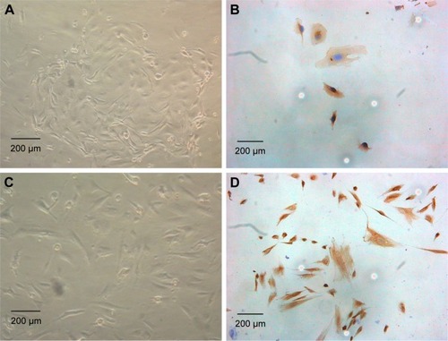 Figure 2 Acquisition of endometrial glandular epithelial cells and mesenchymal cells.