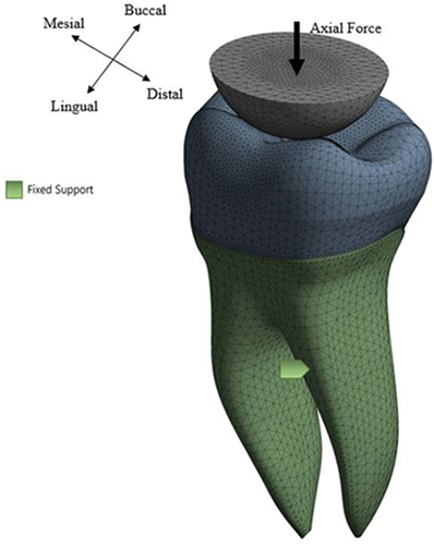 Figure 3. Boundary conditions and applied loading (arrow) for the used model.