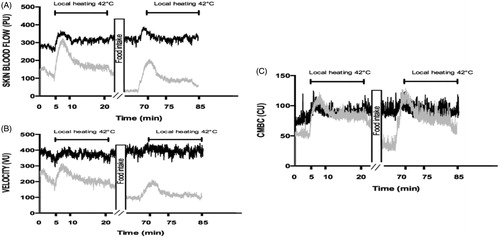 Figure 3. Skin blood flow (PU) and its determinants in response to local heating in women before and after the meal at 20 °C (gray line) and at 31 °C (black line).