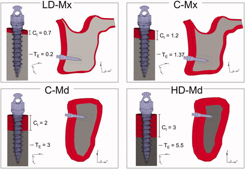 Figure 1. Finite-element models simulating four bone densities conditions: low-dense maxilla (LD-Mx), control maxilla (C-Mx), control mandible (C-Md), and high-dense mandible (HD-Md). Ct: cortical bone thickness (in mm). TE: trabecular bone elastic modulus (in GPa).