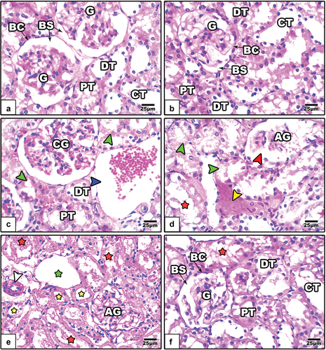 Figure 7. Images of histological sections of renal cortex among the different studied groups of rats (image a: control, image b: GE, images c-e: LPS, and image f: LPS+GE). In images c-e, the glomeruli appear atretic and congested with obvious dilated Bowman’s space (red arrowhead), the proximal and distal tubules appear dilated (yellow stars) with obvious degenerated epithelium (green arrow heads), the walls of collecting tubules appear fragmented (red stars) and dilated (green stars), and dilated capillary (blue arrowhead), thickened blood capillary (white arrowhead). (stain: Hx&E, scale bar: 25).