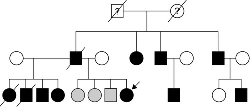 Figure 1 Genealogy tree of the EOAD patients with PSENl T1161 mutation. The symbols filled with black represent the patients with clinical Alzheimer’s disease, while the gray symbols correspond to the family members with mild cognitive impairment (MCI). The arrow indicates the proband being studied here. The history of dementia was not available in first generation of the genealogy tree.