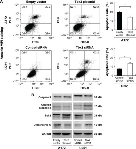 Figure 5 Tbx2 alleviated TMZ-induced apoptosis in GBM cell lines.