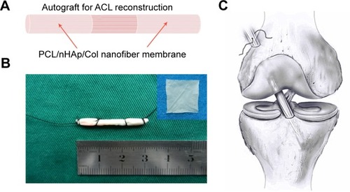 Figure 1 Design of nanofiber membrane for ACL reconstruction.Notes: (A) Illustration of PCL/nHAp/Col nanofiber membrane. (B) PCL/nHAp/Col nanofiber membrane-wrapped tendon. (C) Implantation of the membrane-wrapped tendon into femur and tibia bone.Abbreviations: ACL, anterior cruciate ligament; Col, collagen; nHAp, nanohydroxyapatite; PCL, polycaprolactone.