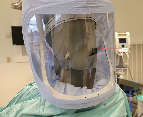 Figure 1. Test setup. The dummy with helmet, hood, and gown in the test setup. Arrow indicating particle counter inside helmet. (White probe is a passive pressure probe not used for tests reported in this paper.)