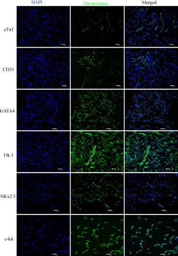 Figure 2. Detection of rat c-kit+ cardiac stem cells markers by immunofluorescence staining. The results show that rat c-kit+ cardiac stem cells at various passages were positive for the c-kit, GATA 4, Nkx2.5 and Flk 1 cell surface markers but cTnT and CD31 were weakly expressed.