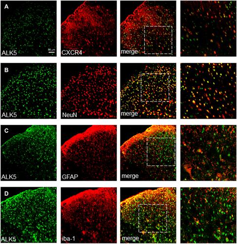 Figure 2 Shown are sections of the spinal cord (L4 - L5) at day 14 (A) Up-regulated expression of both ALK5 and CXCR4. (B–D) Upregulated expression of ALK5 corresponded to markers of neurons in the dorsal horn of the spinal cord and likewise with astrocytes and microglia. Scale bar, 50 μm.